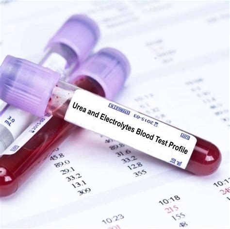 blood test ue|urea and electrolytes test.